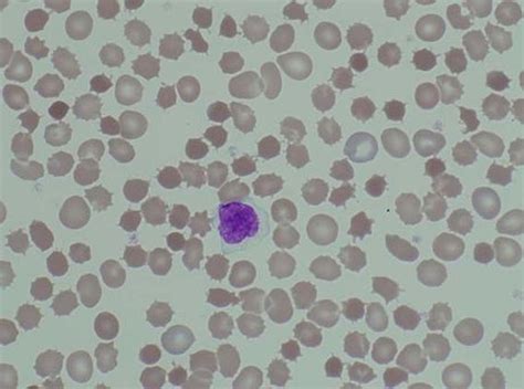 $\begingroup$ do you expect a camel red blood cell to have a drastically different shape than the red blood cells of other mammals? Red Blood Cell Inclusions and Abnormalities - HEMATOLOGY