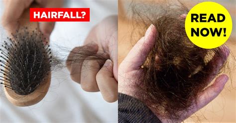 There can be many reasons behind hair loss, whose information we will give further in the article. How To Stop Hair Fall - 20 Tips, Natural Methods & Treatments