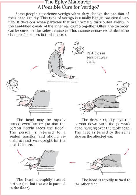 Epley Maneuver Spanish Handout