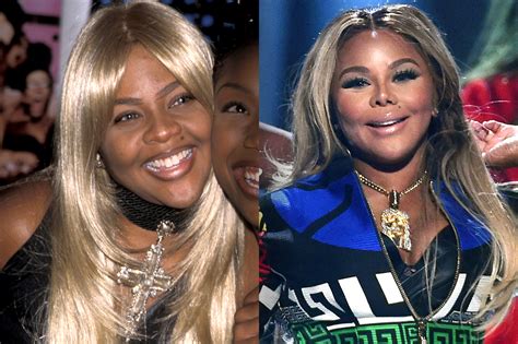 13 Of The Most Drastic Celebrity Plastic Surgeries