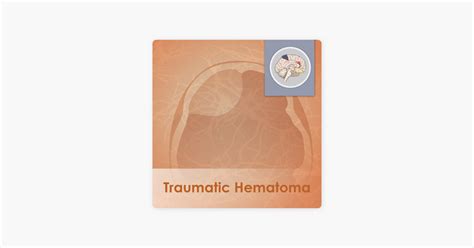 ‎traumatic Hematoma Acute Subdural Hematoma On Apple Podcasts