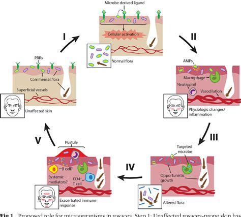 Figure 1 From Potential Role Of Microorganisms In The Pathogenesis Of