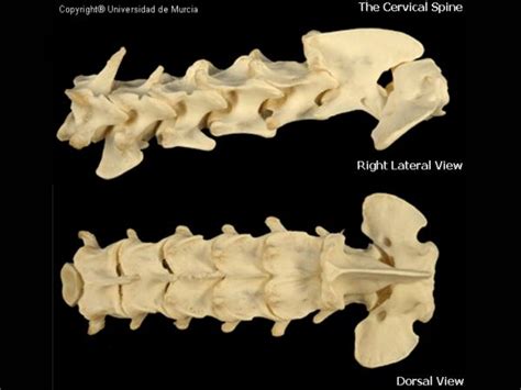 Canine Cervical Vertebrae