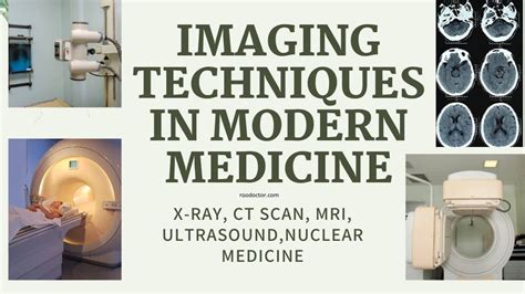From X Rays To Mris Exploring The Various Imaging Techniques