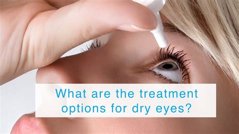 What Are The Treatment Options For Dry Eyes Youtube