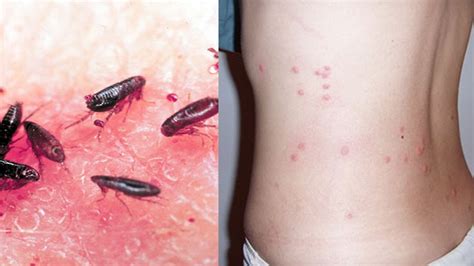 Do all dogs get flees? 3 Best Way To Get Rid Of Fleas In The House - How To Kill ...