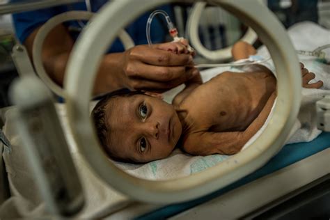Venezuela Guilty Of Child Starvation The Times In Plain English