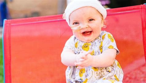 Isla's cleft lip and palate | Newly diagnosed stories