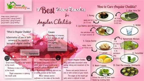 10 Best Home Remedies For Angular Cheilitis Home Remedies