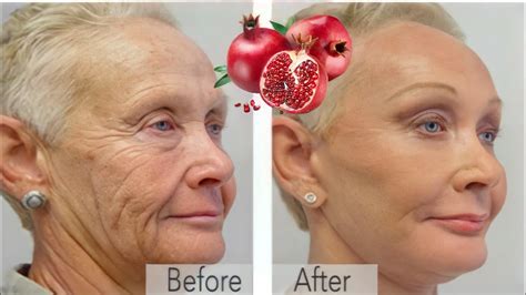 An Ingredient 🌱 A Million Times Stronger Than Botox It Firms The Skin And Eliminates Wrinkles