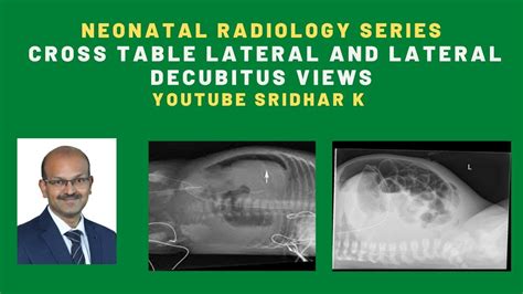 Neonatal Radiology Series When Do We Use Cross Table Lateral View And