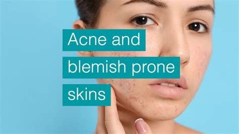 Acne And Blemish Prone Skins At Bodytonic Clinic