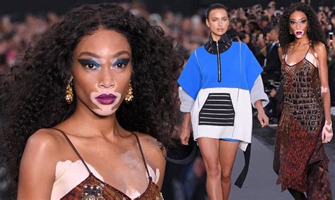 Winnie Harlow Steals Show In The Loreal Paris Show In Pfw Daily Mail