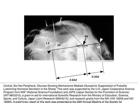 Figure 1 Lateral Radioventriculograph Showing The Location Of The Fourth Ventricle In A Sheep