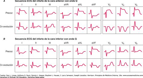 Derivaciones Del Electrocardiograma Pdf Coger Hora Para El Medico My Xxx Hot Girl