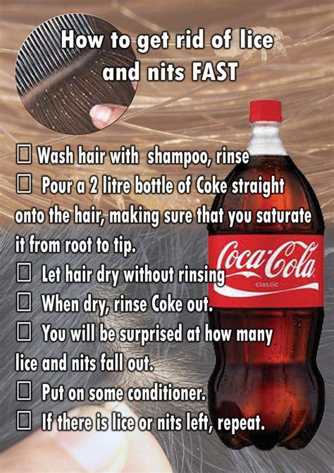 Coca Cola Lice Remedy