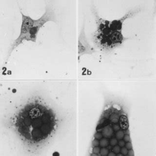 Light Photomicrographs Showing The Four Morphologically Distinct Stages