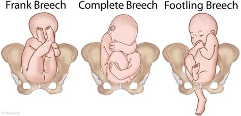Dapat merasakan gerakan bayi dalam kandungan merupakan hal yg luar biasa. 4 Posisi Bayi dalam Kandungan yang Wajib Diketahui Ibu ...