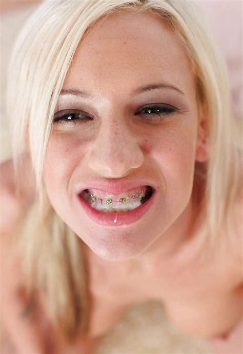 Blonde Teen Smiling With Cum Covered Braces Rbraceface