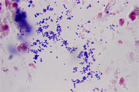 Bacterial Morphology Microbiology Learning The Whyology Of