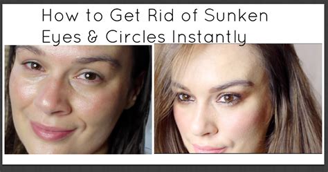 Avoid consuming alcohol take adequate sleep do not rub your eyes blink the eyes fifteen times in a minute. beautiful me plus you: How to Get Rid of Sunken Eyes ...