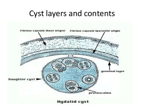 Hydatid Cyst