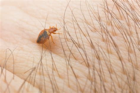 Natural Ways To Get Rid Of Bed Bugs Bed Bug Bbq Cleveland