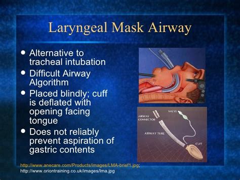 Laryngeal Mask Airway Vs Endotracheal Tube