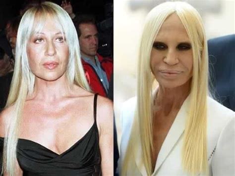 The Most Expensive Celebrity Plastic Surgeries Ever And How Much They Cost Botched Plastic