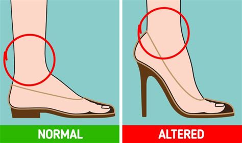 What Can Happen To Your Body If You Wear High Heels Every Day Telegraph