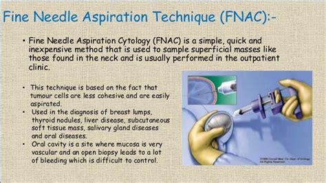 Fine Needle Aspiration Cytology Fnac