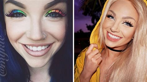 Celebrities With Veneers Who Are Open About Their Experience