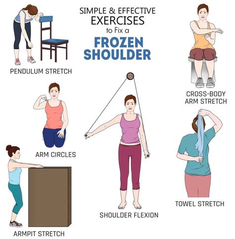 Frozen Shoulder Rehab Exercises Hot Sex Picture