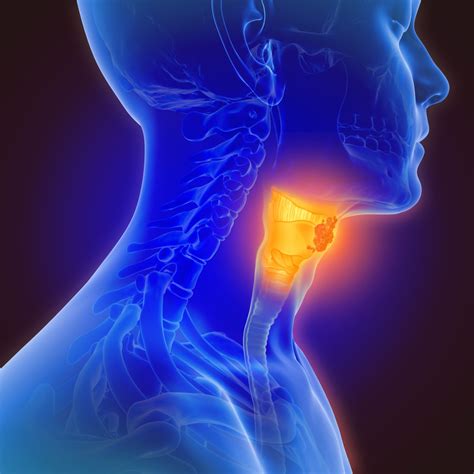 Mouth Pharynx Larynx Cancers American Institute For Cancer Research