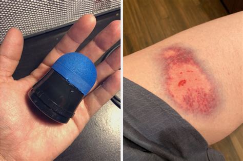 Here’s What Rubber Bullets Actually Look Like And It’s Pretty Upsetting Gonetrending