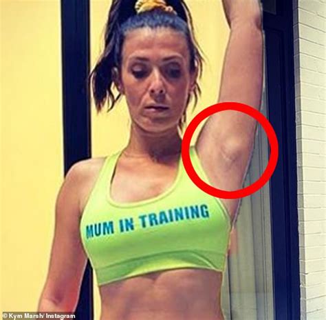 Kym Marsh Gets A Lump In Her Armpit Checked After Fans Voiced Concern Hot Lifestyle News