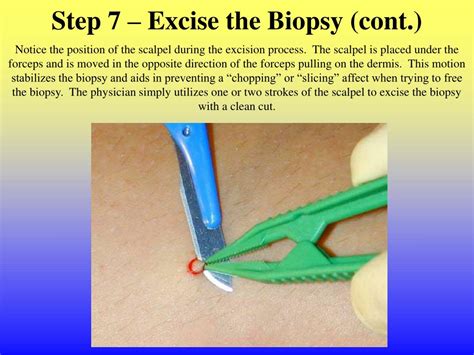 Ppt Johns Hopkins Cutaneous Nerve Laboratory Skin Biopsy Procedure