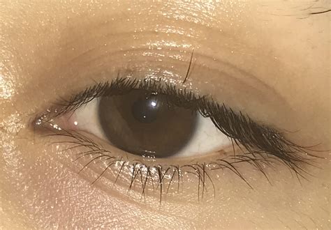 This Eyelash I Have Growing On My Eyelid Rmildlyinteresting