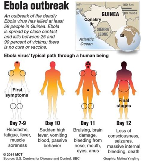 Check spelling or type a new query. Ebola Outbreak: 14 Things to Know about the Deadly Disease ...