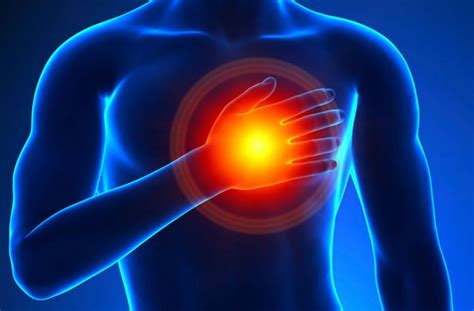 Angina de pecho síntomas causas y prevención HiBooX