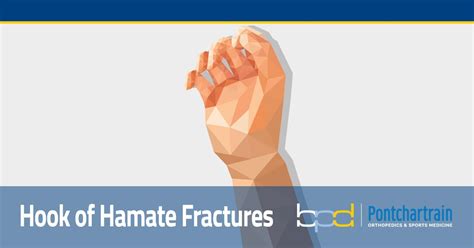 Hook Of Hamate Fractures Brandon P Donnelly Md