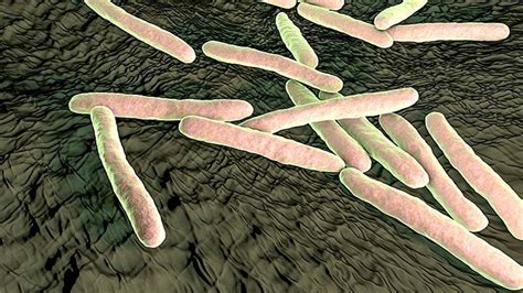 What Are Mycobacterium Avium Complex Infections Causes Treatment