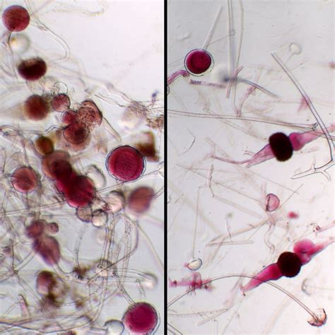 Rhizopus Sporangia Slide