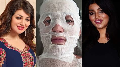 Top 8 Bollywood Actress Plastic Surgery Before And After Gone Horribly