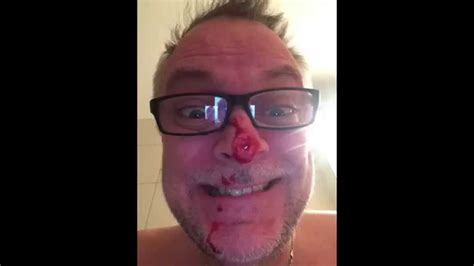 Anomaly autism anomaly and papanomaly vlog irl real life asperger. Himalaya - YouTube