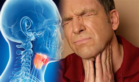 Throat Cancer 6 Of The Most Common Symptoms Of Throat Cancer That You