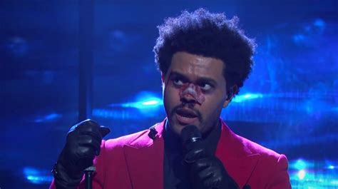 He's known for such hits as can't feel my face, starboy and i feel it coming. The real reason The Weeknd's face is still battered
