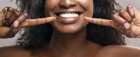 Benefits Of Professional Teeth Whitening Cakmes Dental Studio