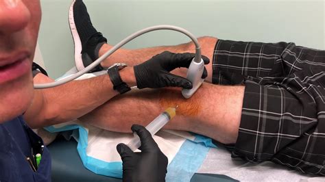 Moramd Platelet Rich Plasma Prp For Knee Arthritis Live Injection