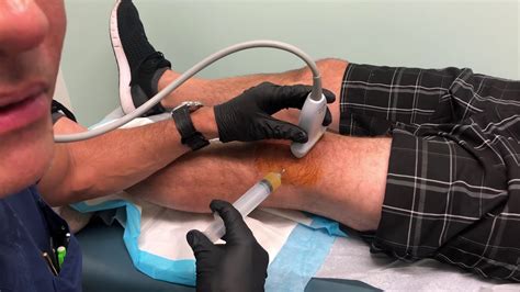 MoraMD Platelet Rich Plasma PRP For Knee Arthritis Live Injection With Dr Steve Mora YouTube